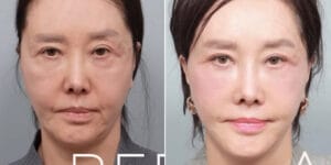 “못 알아볼 정도로 달라졌다” 유혜리, 62세에 공개한 안면거상 후 변화가 화제인 이유